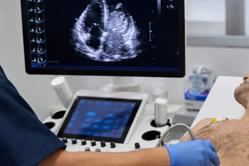 Ecocardiograma Transesofágico (ETE) en Veracruz